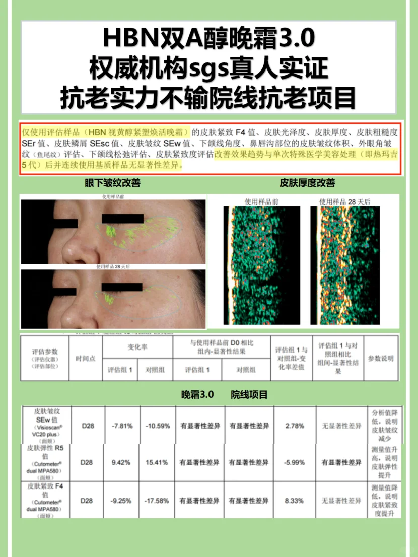 CDA挖料:HBN牵头!护肤不再交智商税