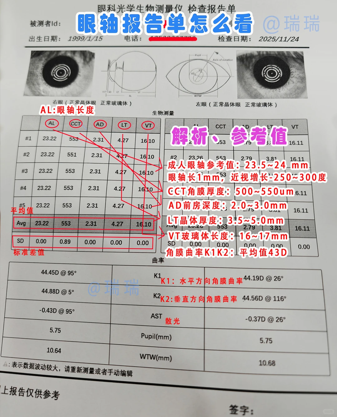 一张图看懂眼轴报告单?