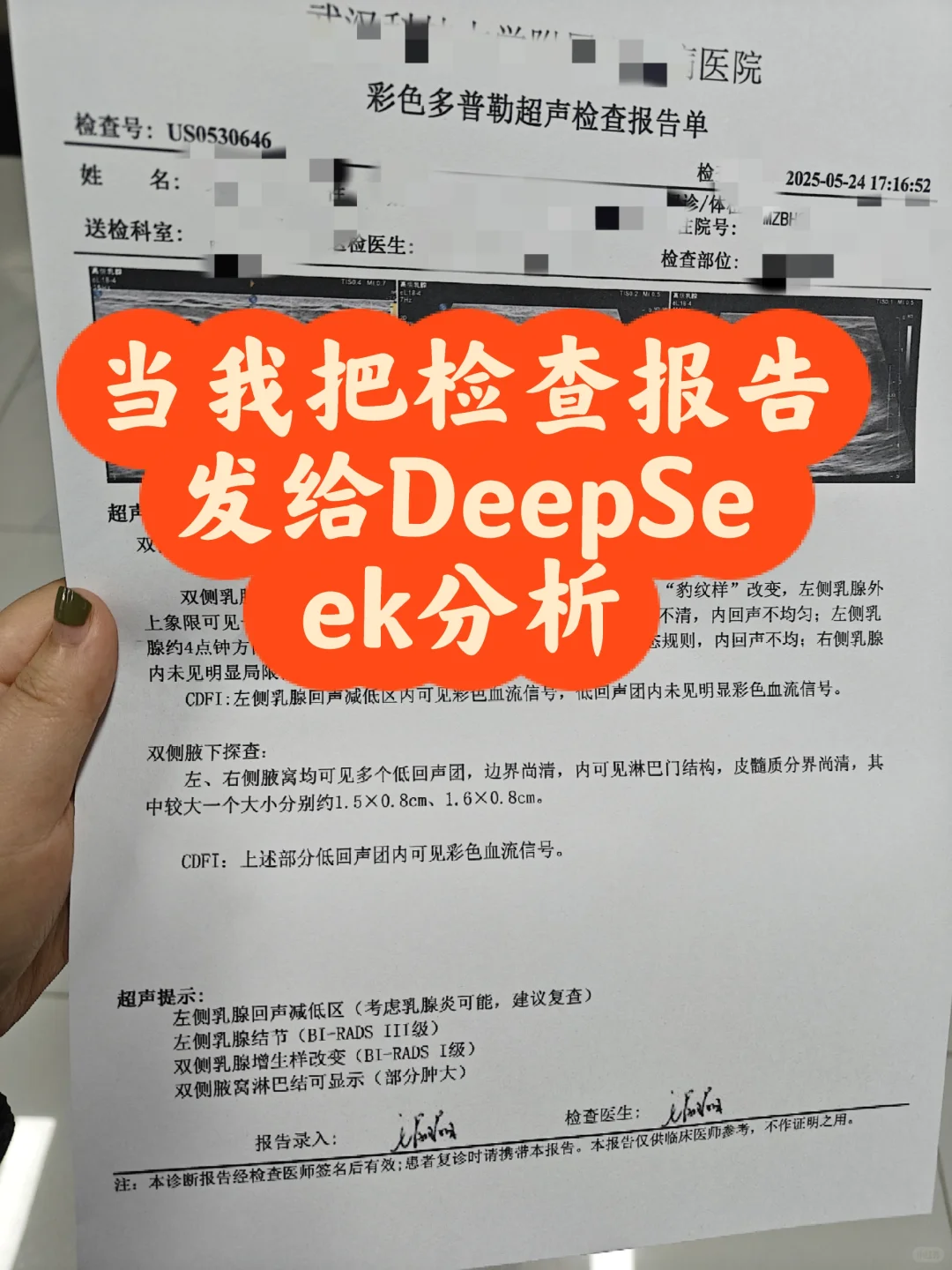 当我把彩超单子发给DeepSeek后……