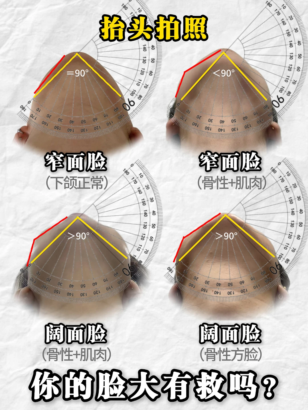 咬肌还是骨骼？宽脸还是窄脸？如何大脸变小