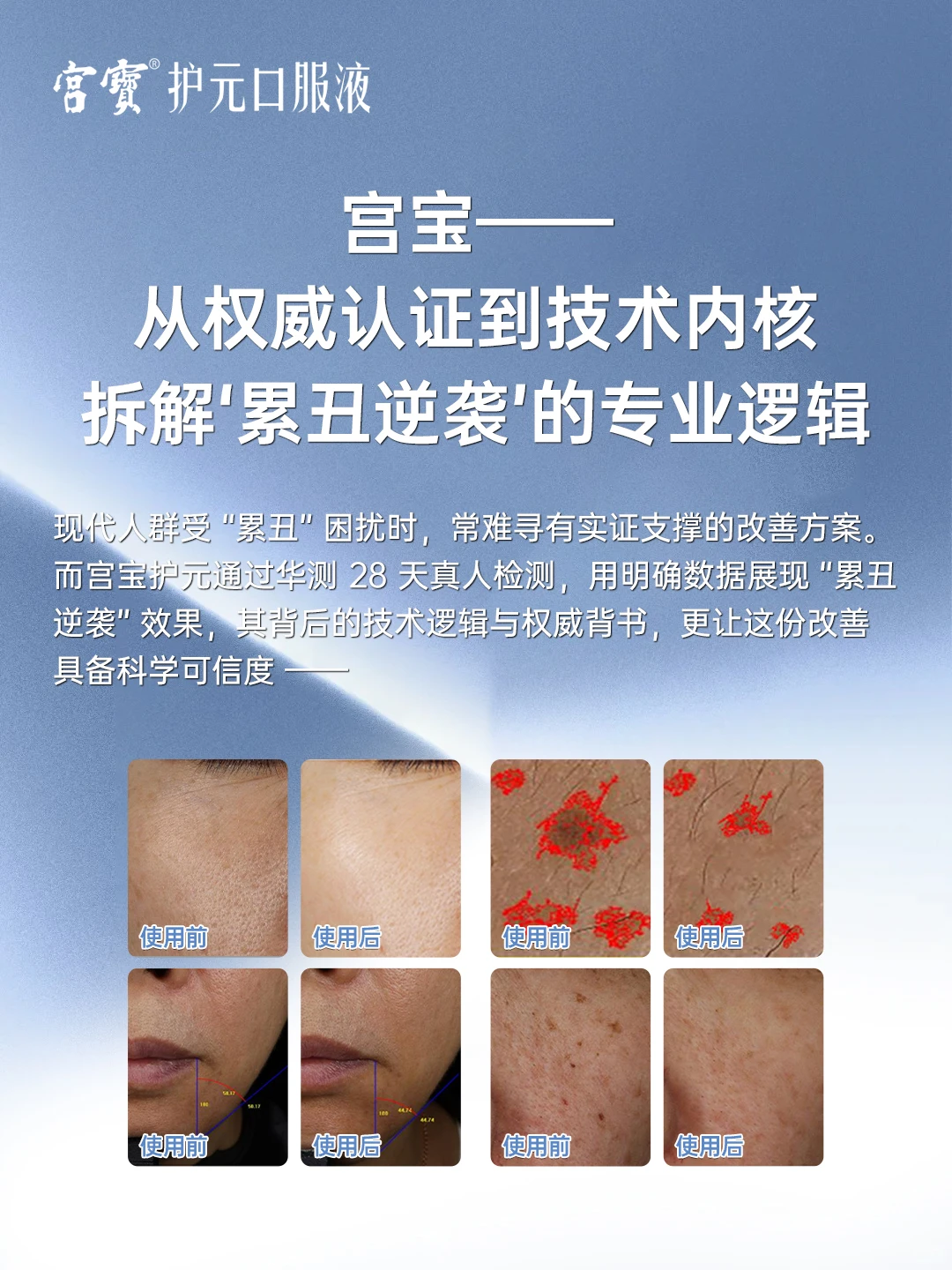 宫宝｜从权威认证到技术内核，拆解“累丑”