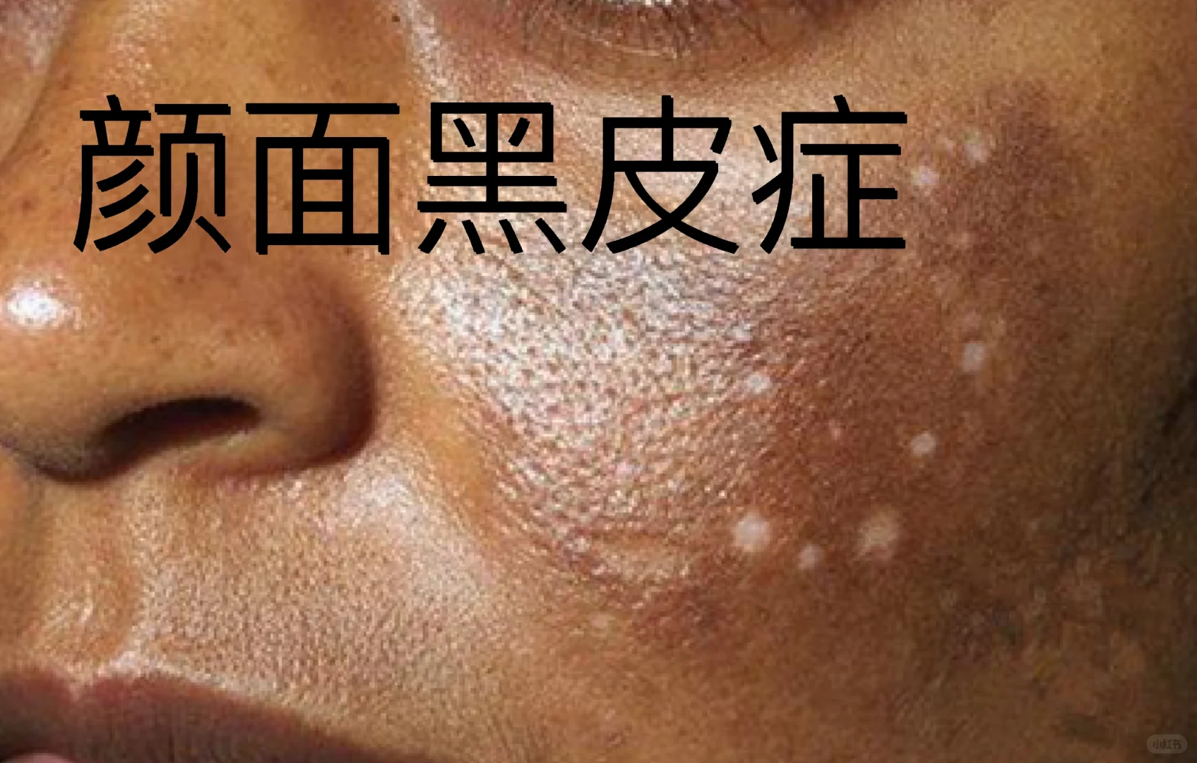 护肤品发展史 化工到零添加护肤