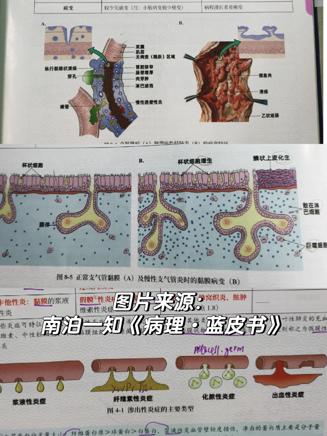 西综266:正式介绍我的真正王炸