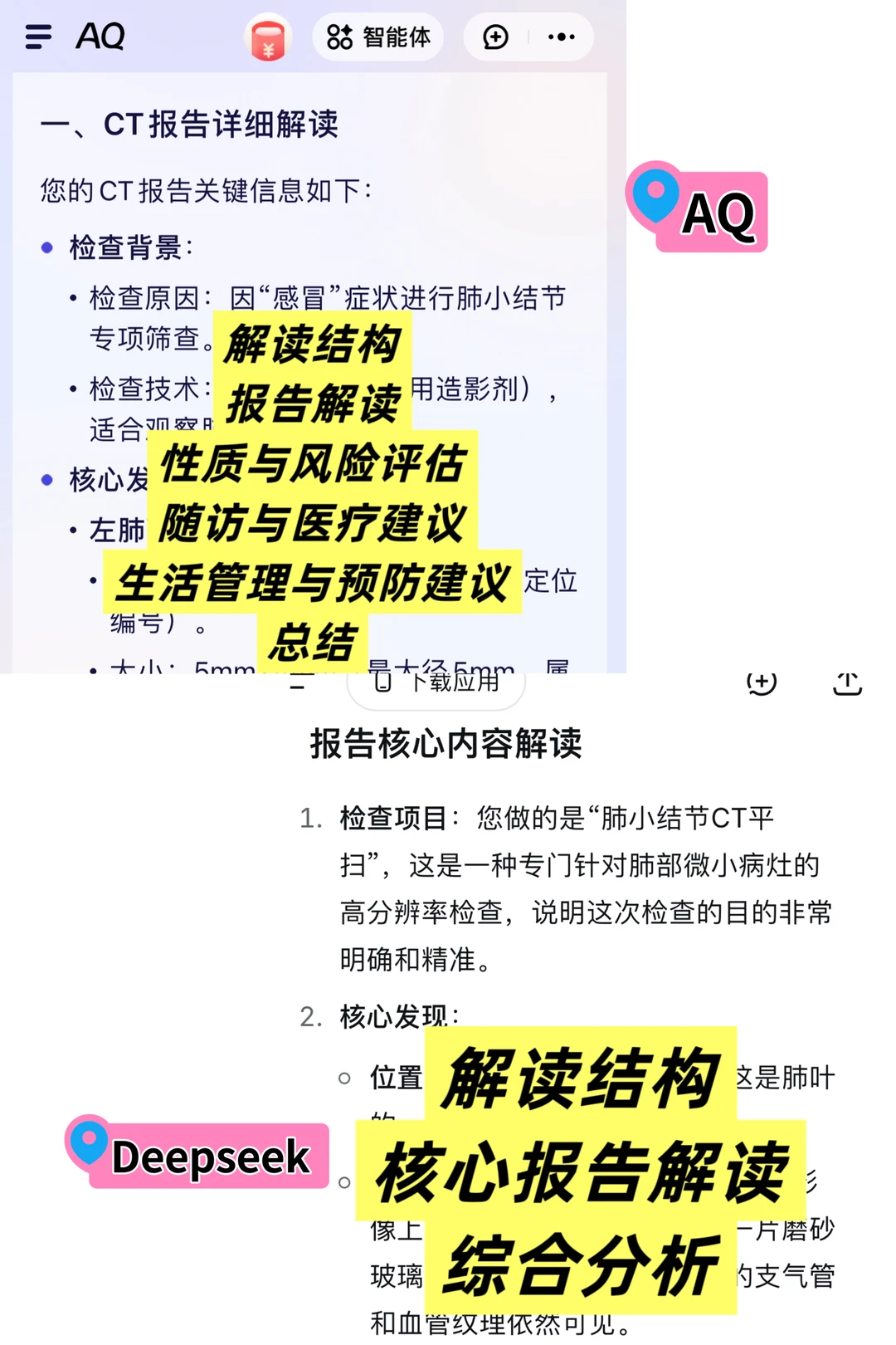 把肺结节报告发给不同AI,解读真的有差别