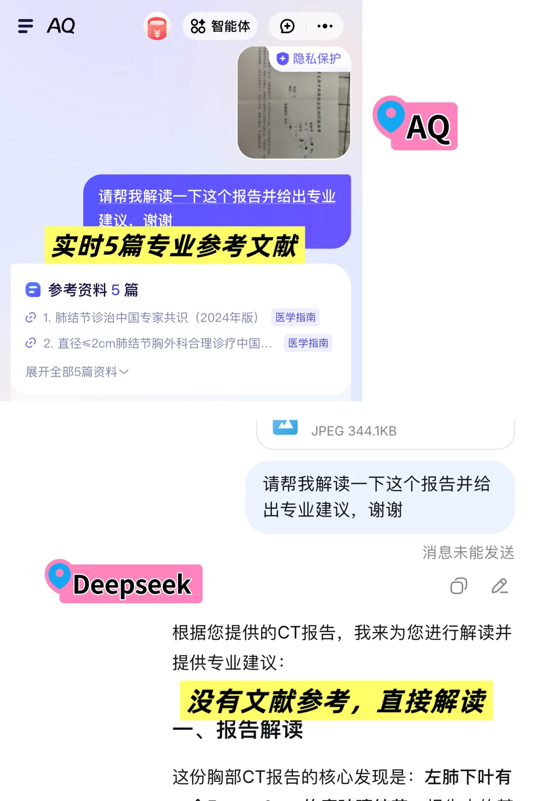 把肺结节报告发给不同AI,解读真的有差别