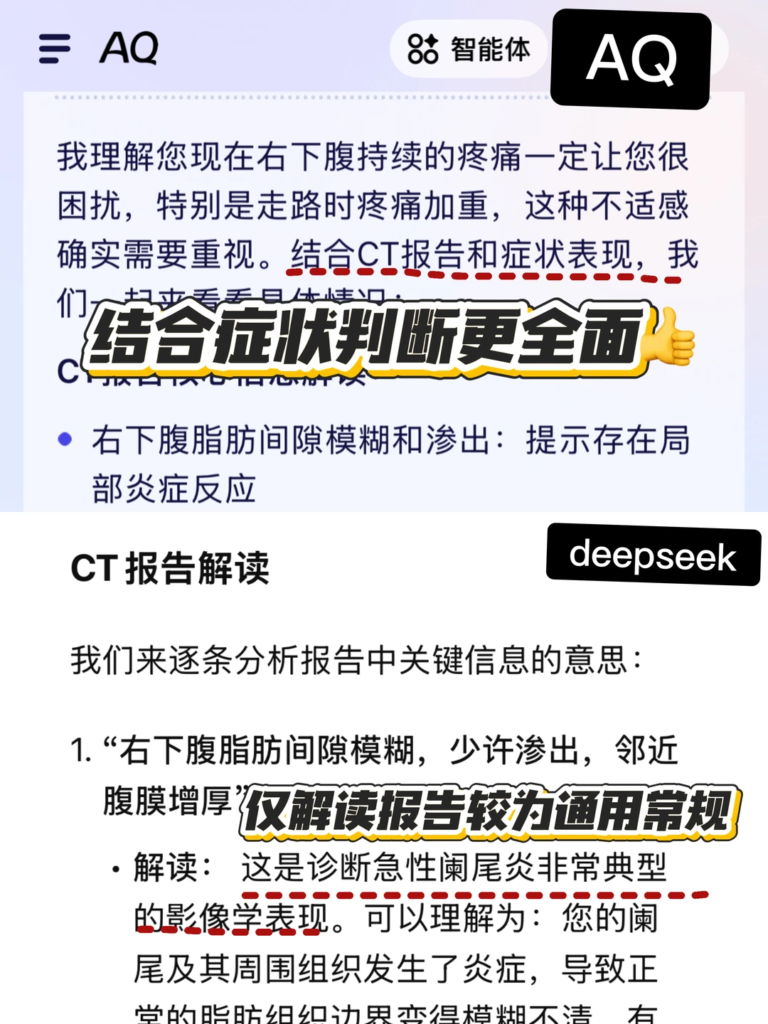 用AI看检查报告,?我的阑尾?焦虑