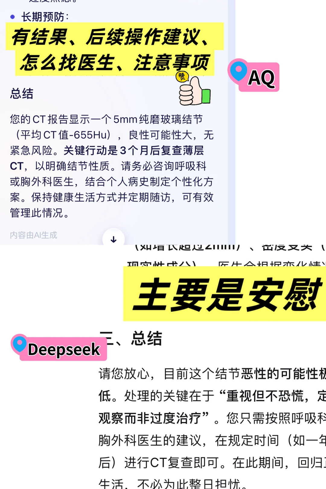 把肺结节报告发给不同AI,解读真的有差别