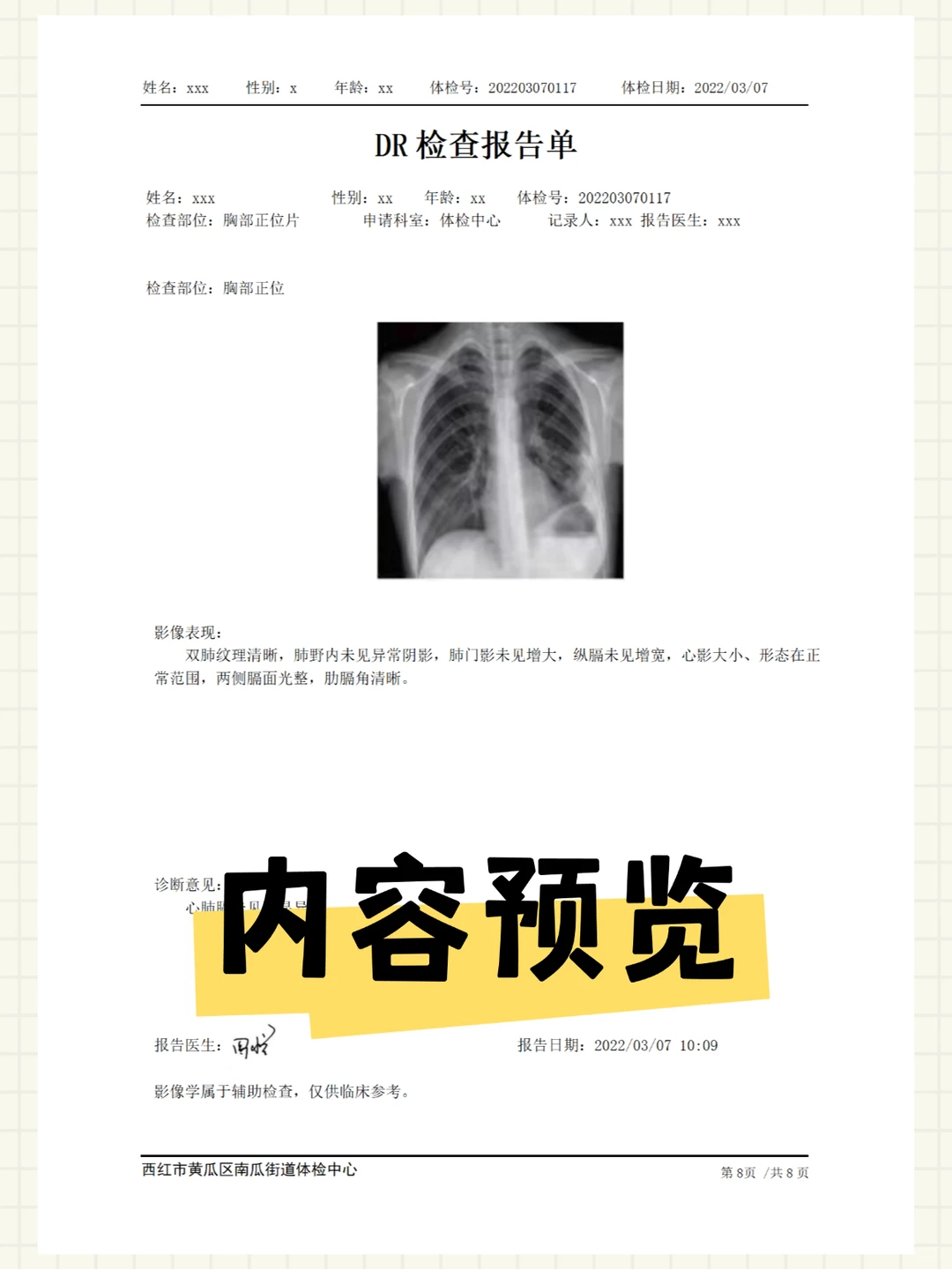 ?员工入职体检报告 Word 模板三甲医院