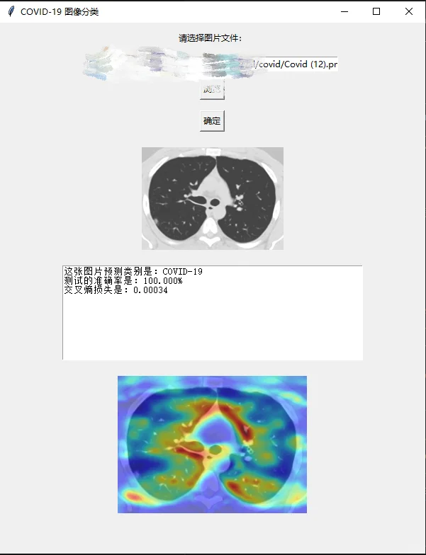 深度学习图像分类大作业
