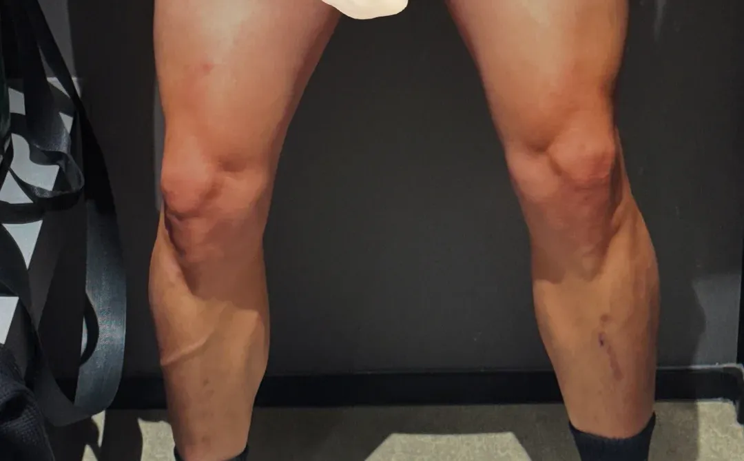 左滑看粗??