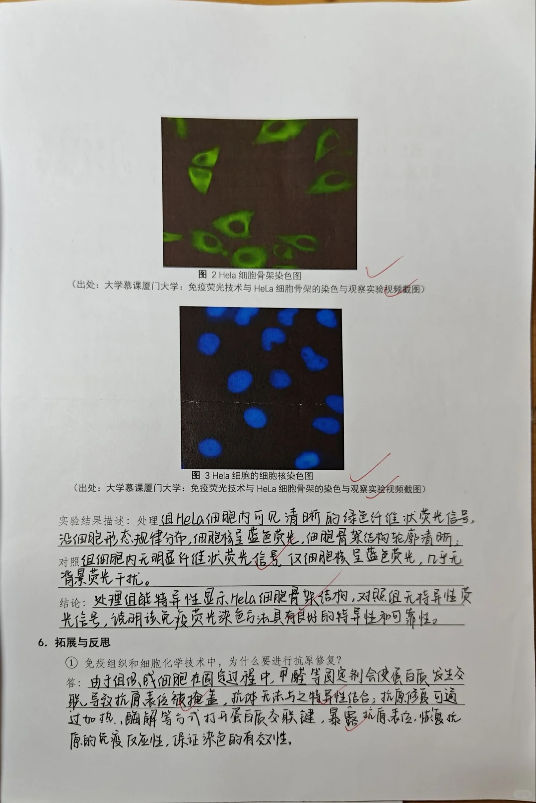 免疫荧光技术与HELA细胞骨架的染色与观察