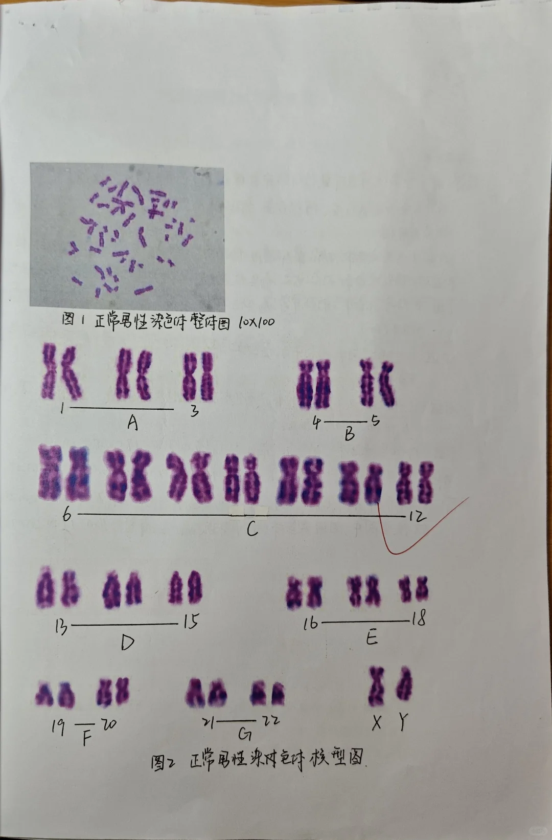 人类染色体G带观察与核型分析