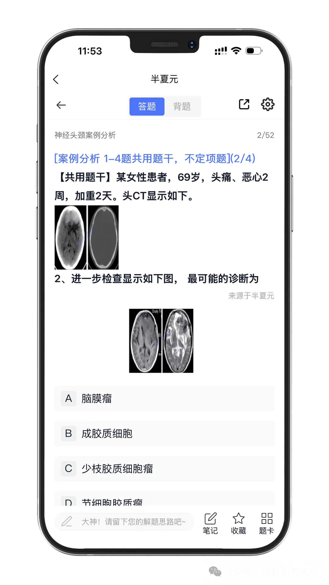 【放射医学主治医师题库】真题多、案例题多,实时更新(免费领取)-第2张图片-四季读书网 【放射医学主治医师题库】真题多、案例题多,实时更新(免费领取)-第2张图片-四季读书网
