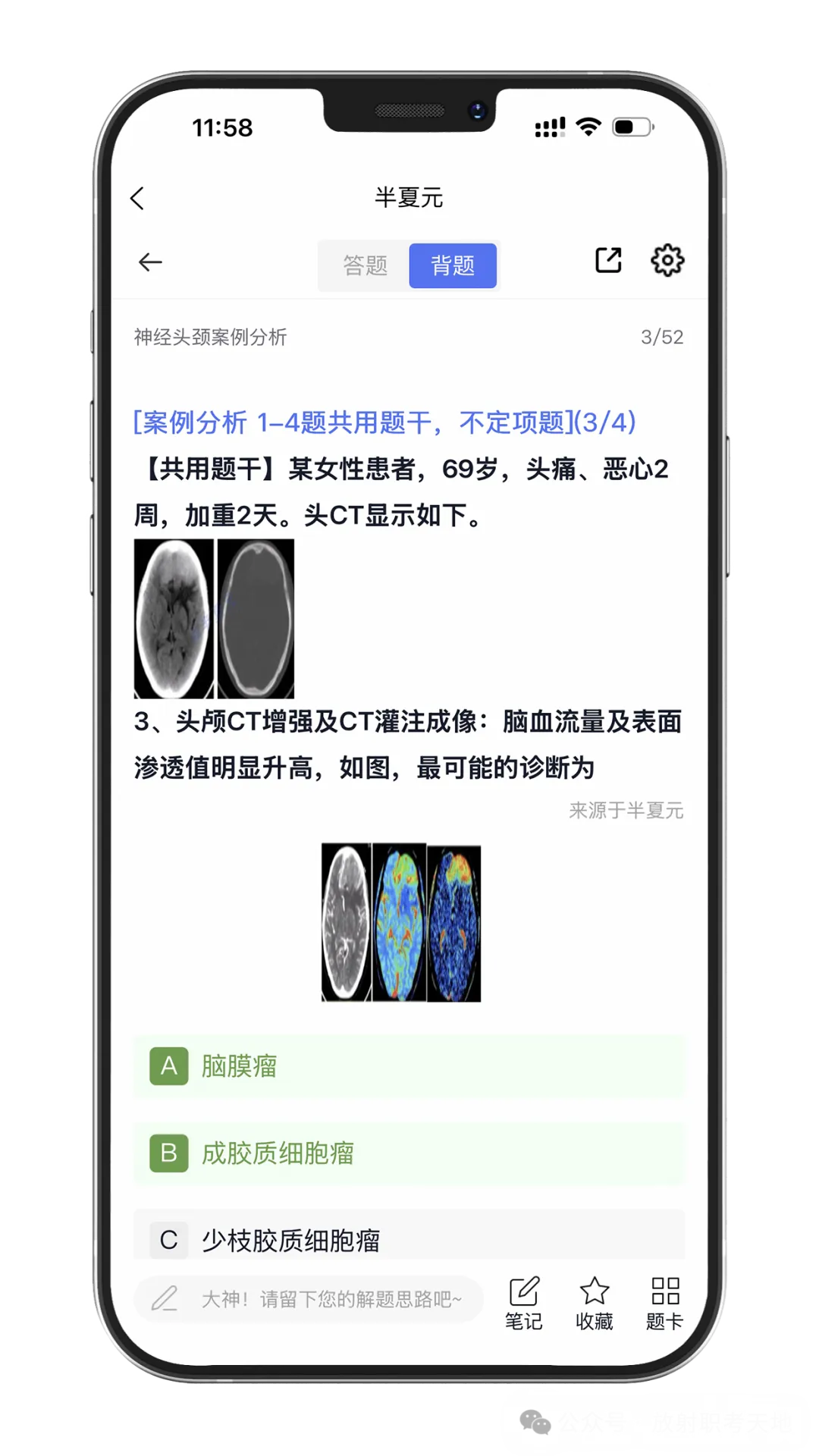 【放射医学主治医师题库】真题多、案例题多,实时更新(免费领取)-第3张图片-四季读书网 【放射医学主治医师题库】真题多、案例题多,实时更新(免费领取)-第3张图片-四季读书网