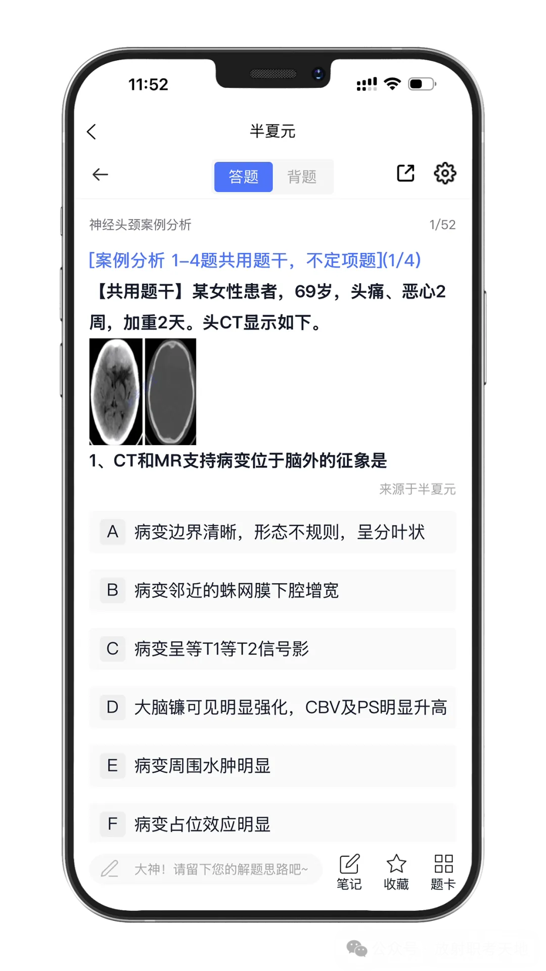 【放射医学主治医师题库】真题多、案例题多,实时更新(免费领取)-第4张图片-四季读书网 【放射医学主治医师题库】真题多、案例题多,实时更新(免费领取)-第4张图片-四季读书网