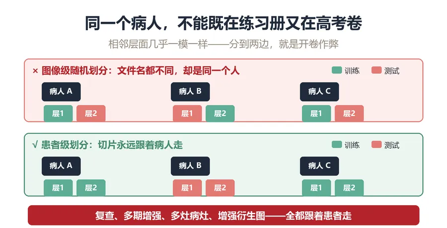 从“模拟考到高考”讲清楚:影像AI数据集划分、防数据泄漏与交叉验证怎么做-第2张图片-四季读书网 从“模拟考到高考”讲清楚:影像AI数据集划分、防数据泄漏与交叉验证怎么做-第2张图片-四季读书网