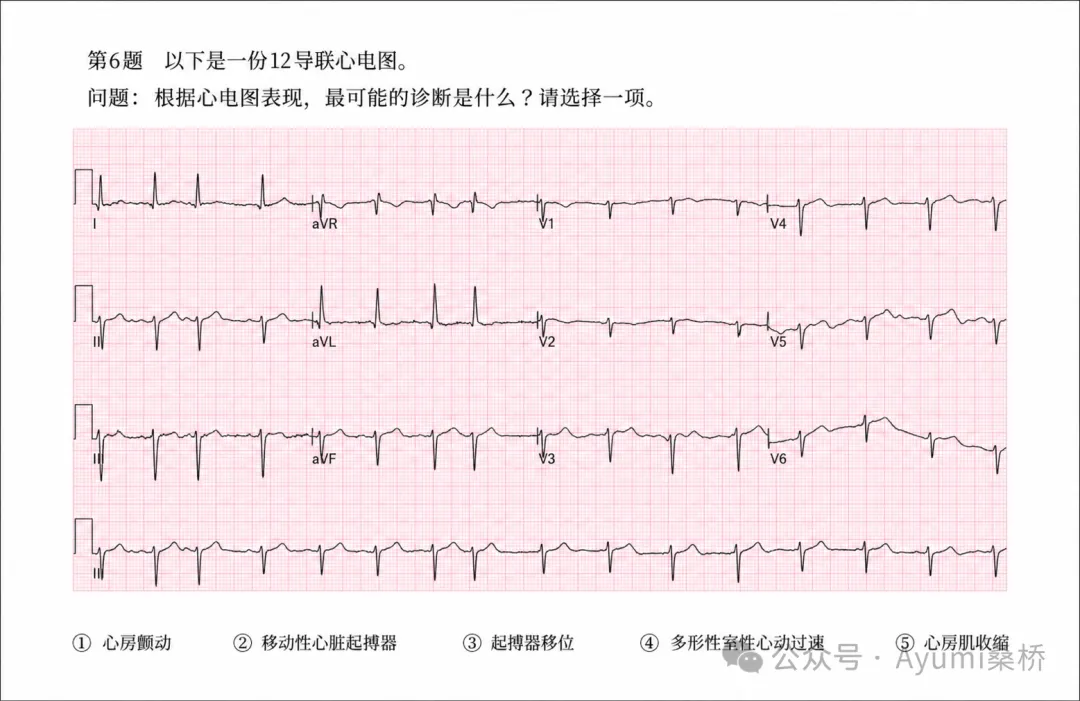 心电图检定1级模拟考试6-10问解析-第1张图片-四季读书网 心电图检定1级模拟考试6-10问解析-第1张图片-四季读书网