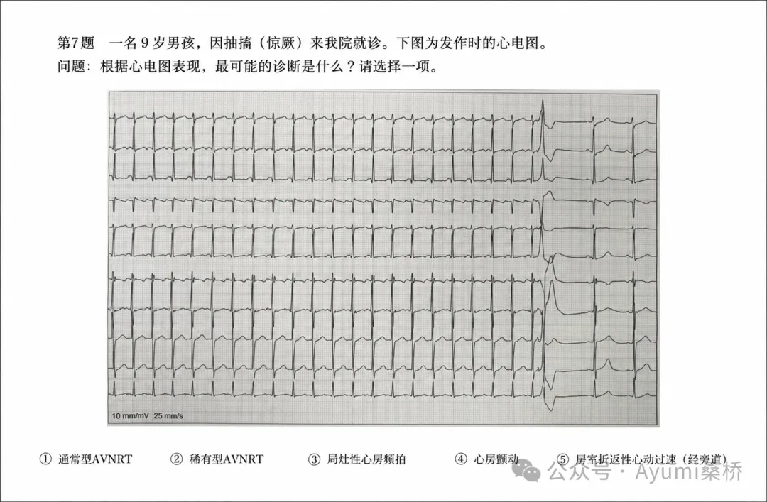 心电图检定1级模拟考试6-10问解析-第2张图片-四季读书网 心电图检定1级模拟考试6-10问解析-第2张图片-四季读书网