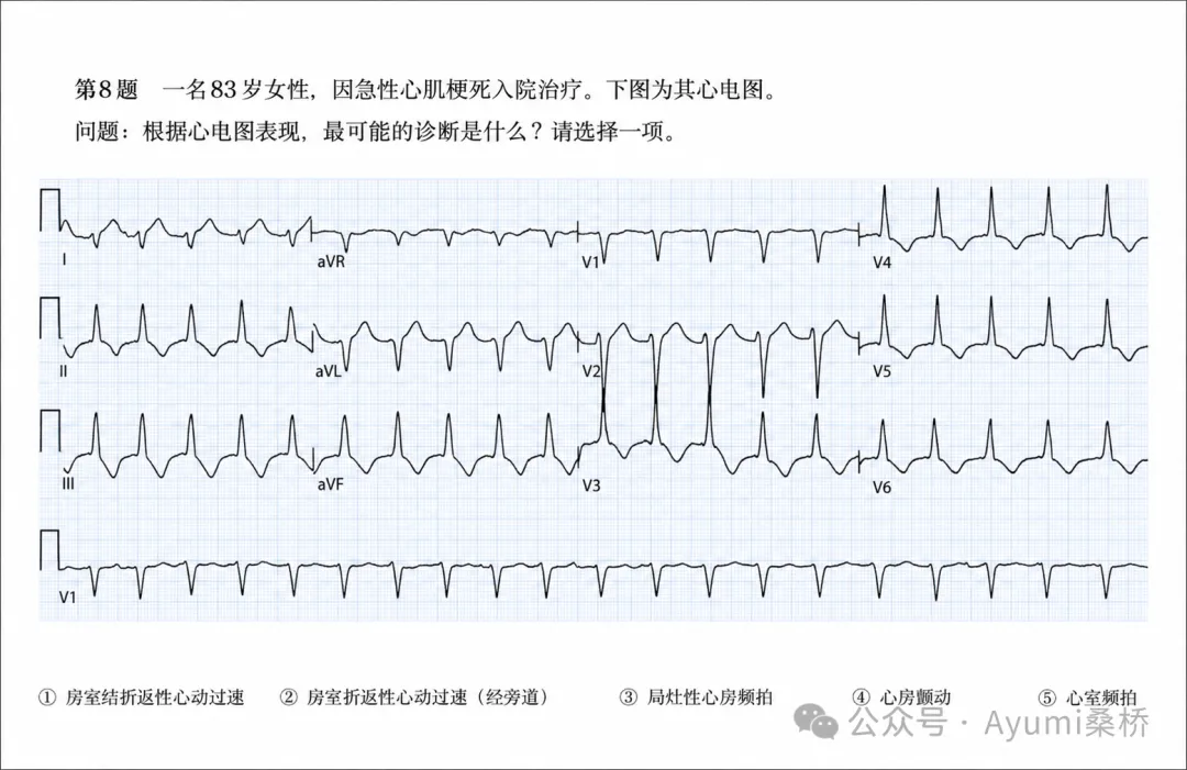 心电图检定1级模拟考试6-10问解析-第3张图片-四季读书网 心电图检定1级模拟考试6-10问解析-第3张图片-四季读书网