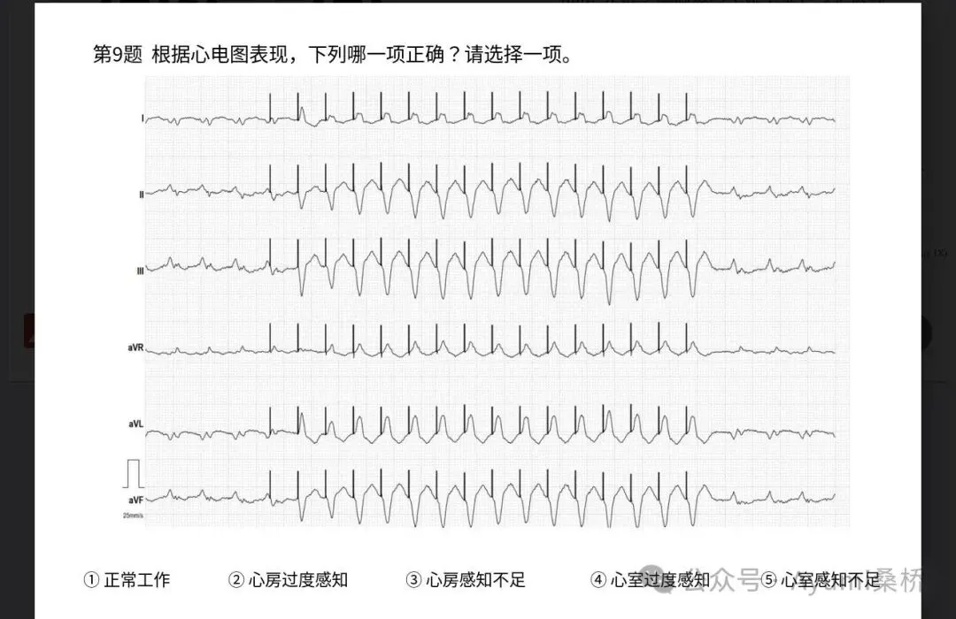 心电图检定1级模拟考试6-10问解析-第4张图片-四季读书网 心电图检定1级模拟考试6-10问解析-第4张图片-四季读书网
