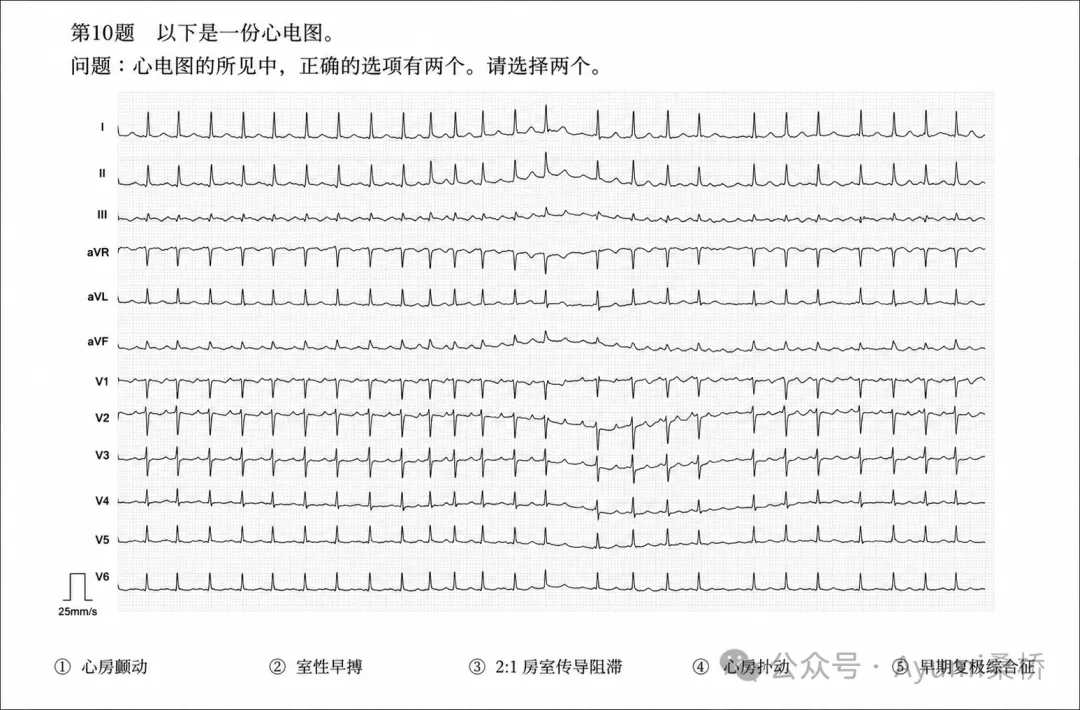 心电图检定1级模拟考试6-10问解析-第5张图片-四季读书网 心电图检定1级模拟考试6-10问解析-第5张图片-四季读书网