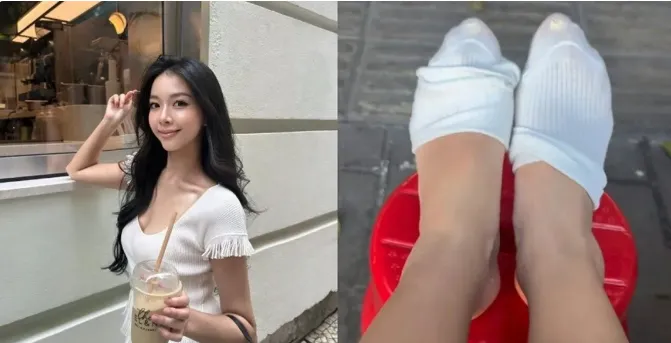 24岁港姐亚军桂林旅游遇意外,右脚踝肿得吓人,网友催她赶紧就医!