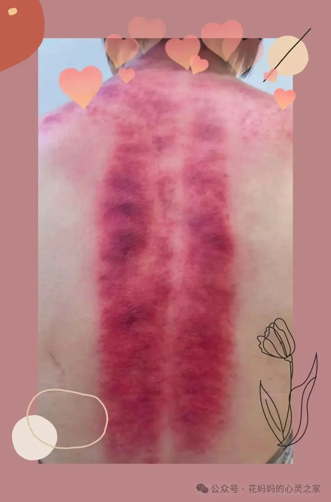 高考在即,如何缓解考前综合征?-第5张图片-四季读书网