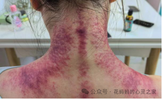 高考在即,如何缓解考前综合征?-第4张图片-四季读书网