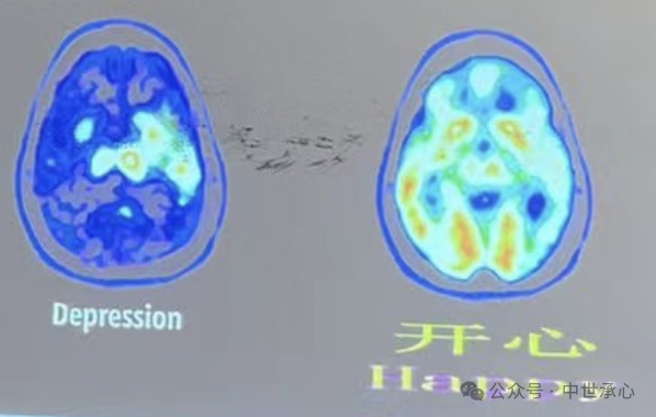【干货】助力中高考-考前应急减压分享实录 第5张 【干货】助力中高考-考前应急减压分享实录 第5张