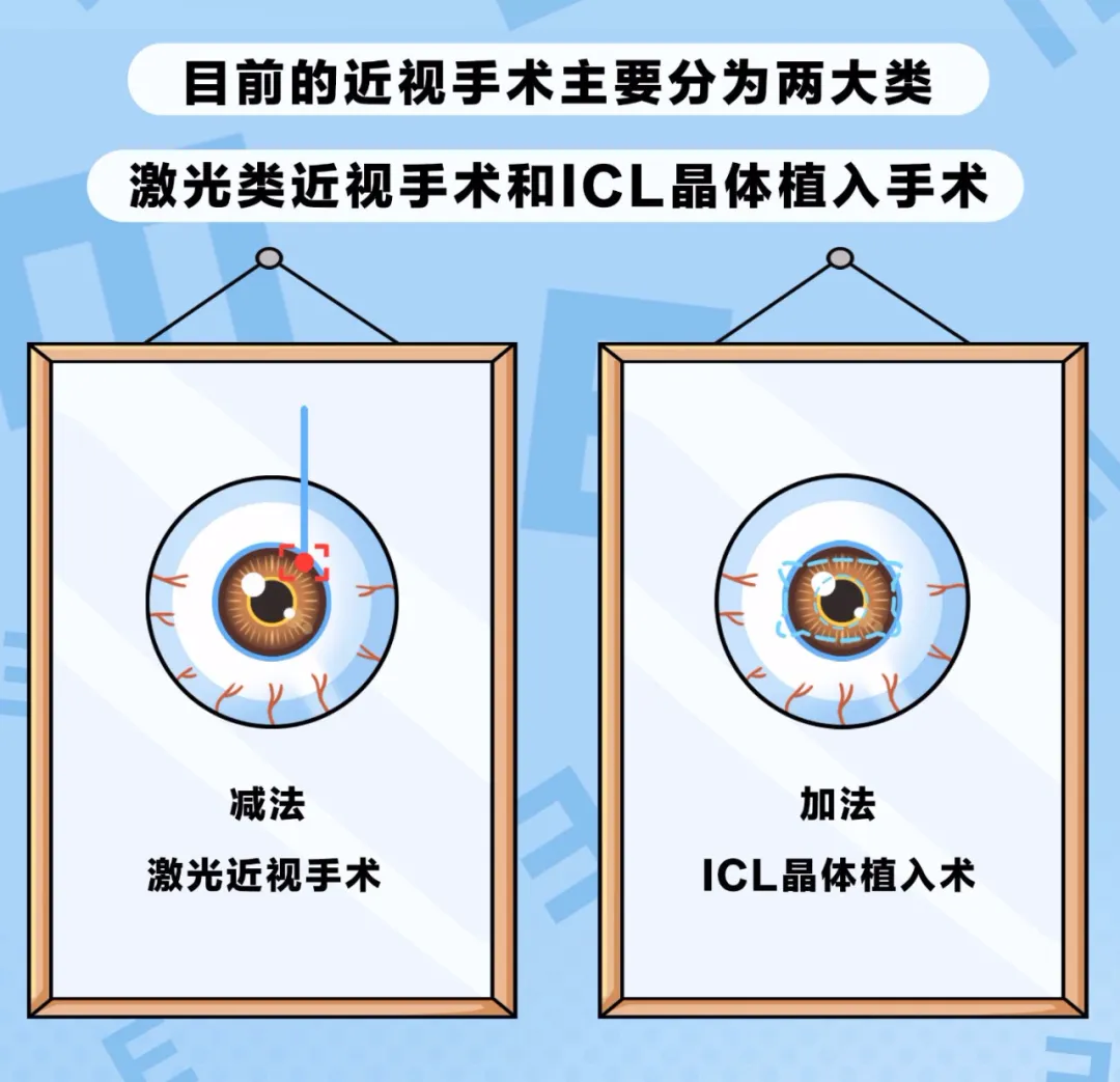 高考后想做近视眼手术?这些注意事项先搞清楚! 第4张 高考后想做近视眼手术?这些注意事项先搞清楚! 第4张