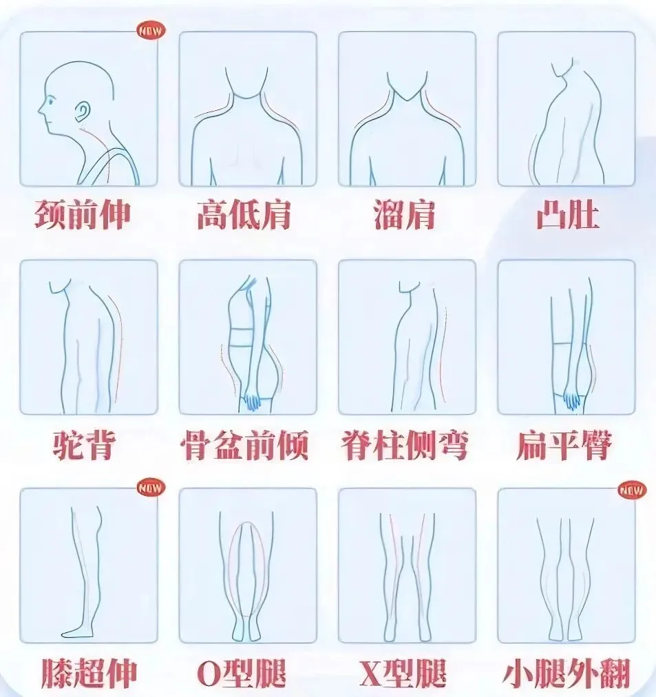 中考体育想拿满分?先别急着练,看看这份“避坑”指南! 第5张 中考体育想拿满分?先别急着练,看看这份“避坑”指南! 第5张