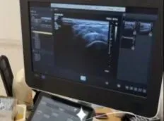 中考百日蓄力 心理护航逐梦——松原市中心医院走进慧仁实验学校开展心理讲座 第8张