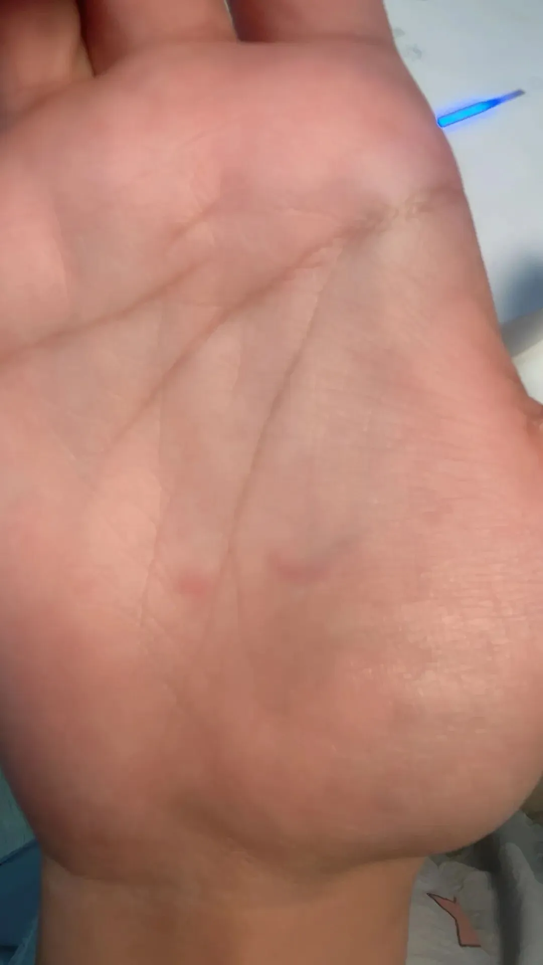 中考体育考试,儿子把自己手心都掐红了 第1张