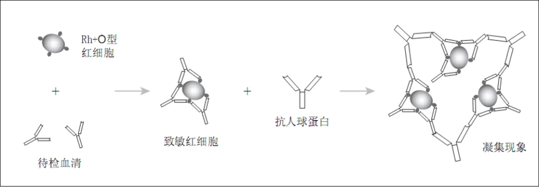 历年真题反复考!凝集反应这几个坑,检验技师考生90%都踩过 第8张 历年真题反复考!凝集反应这几个坑,检验技师考生90%都踩过 第8张