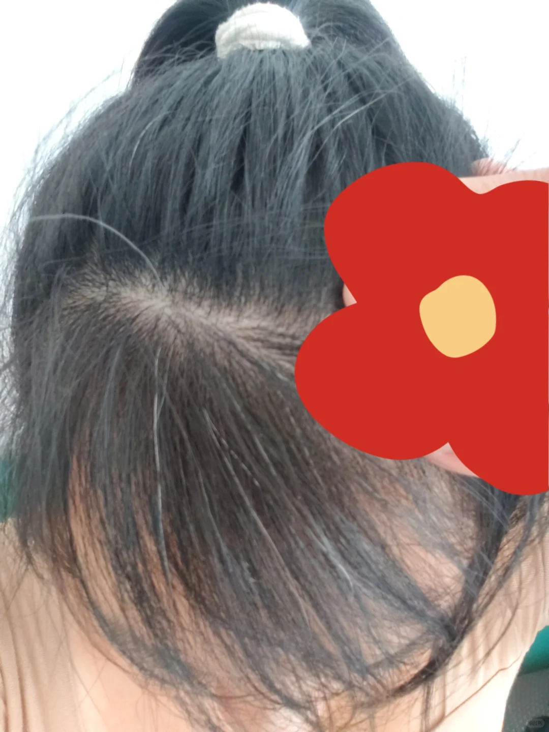 关于白头发
