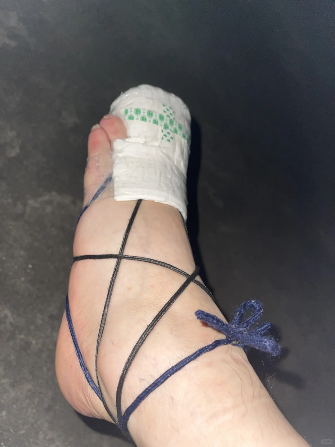 裸足脚趾素甲