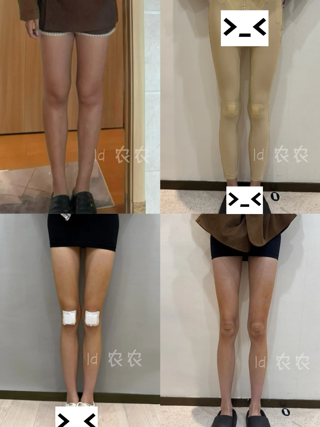 大小腿细了