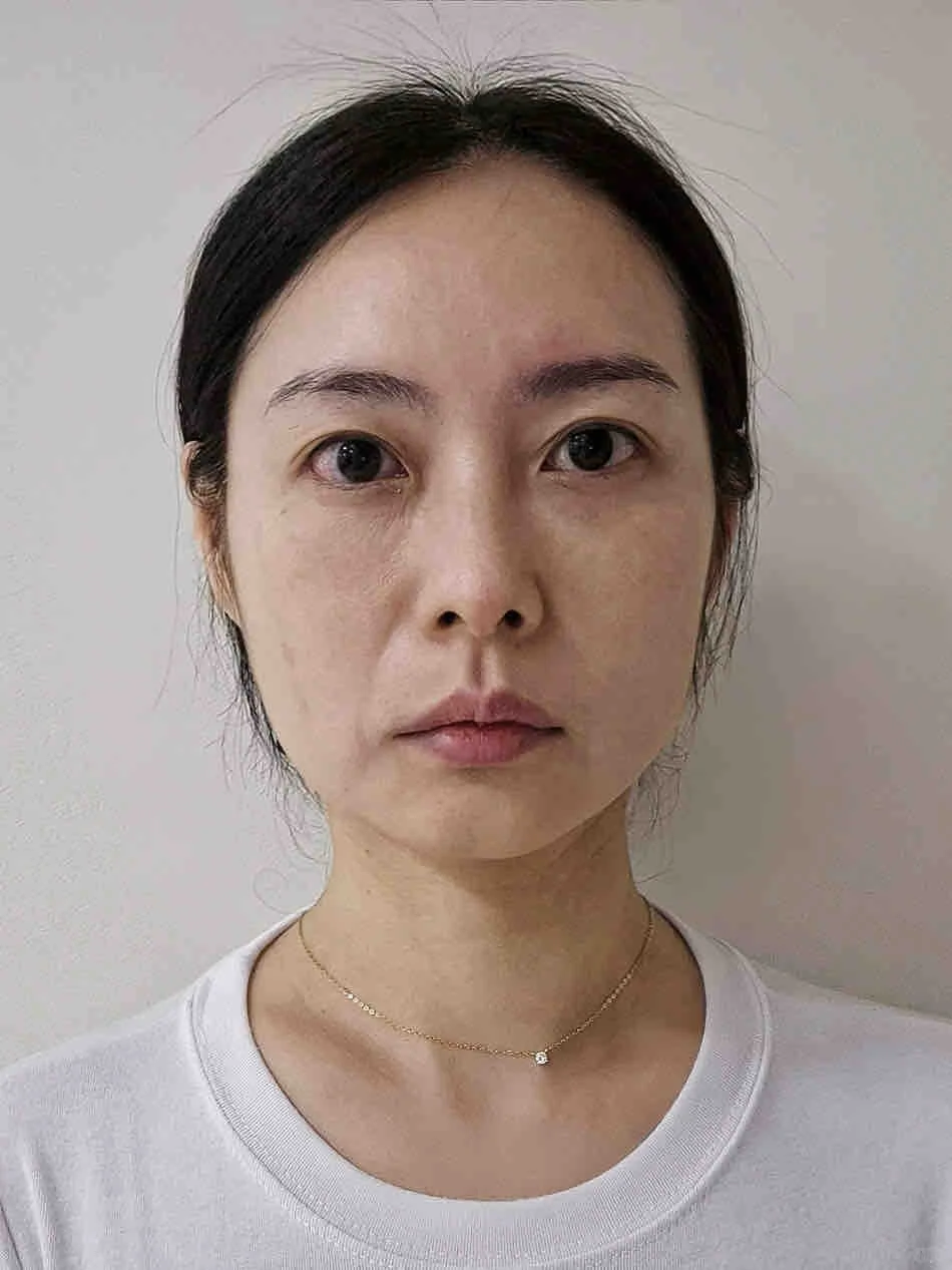 88年38岁，脸垮的不能看