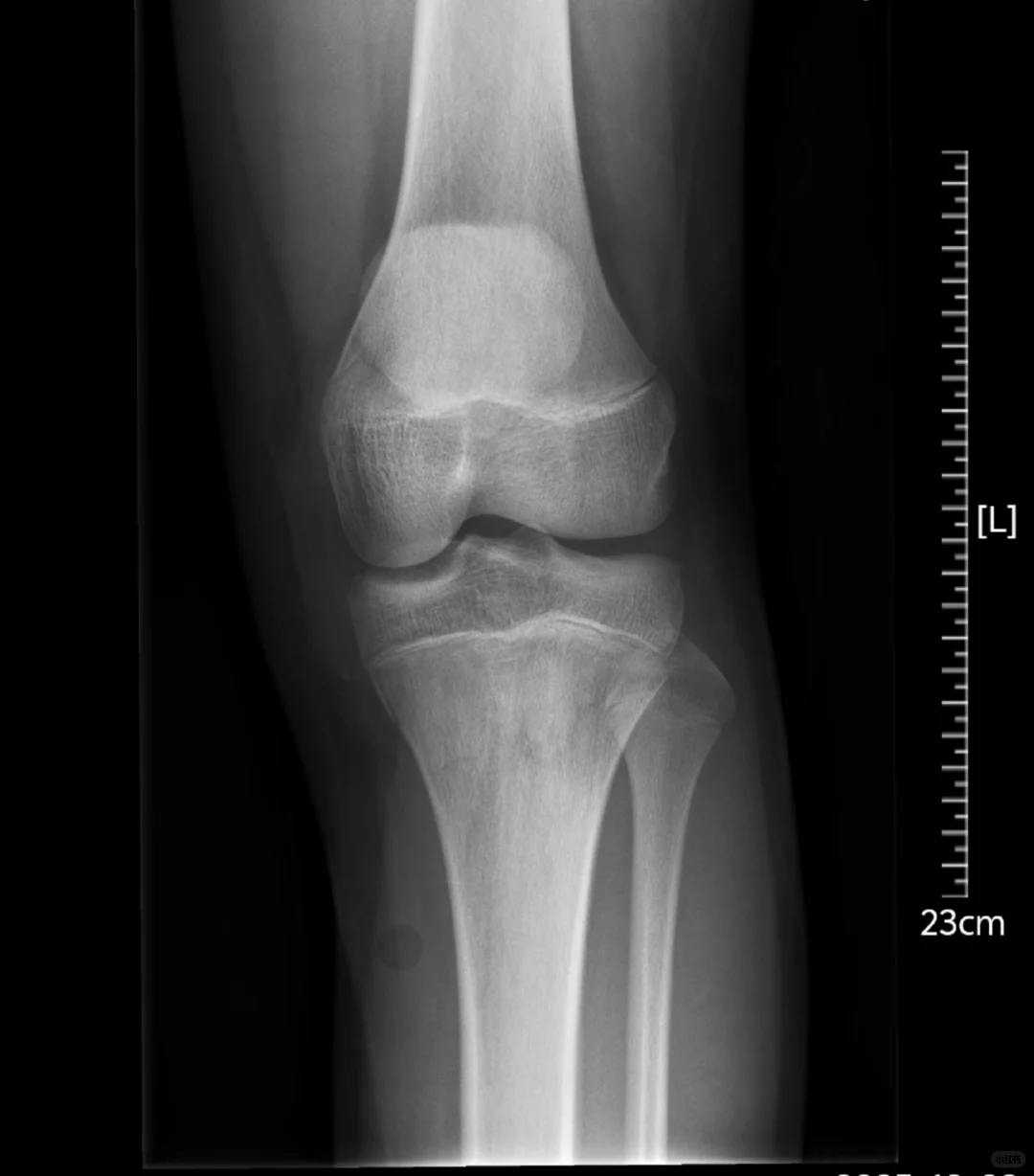 要中考了，怎么办 第1张