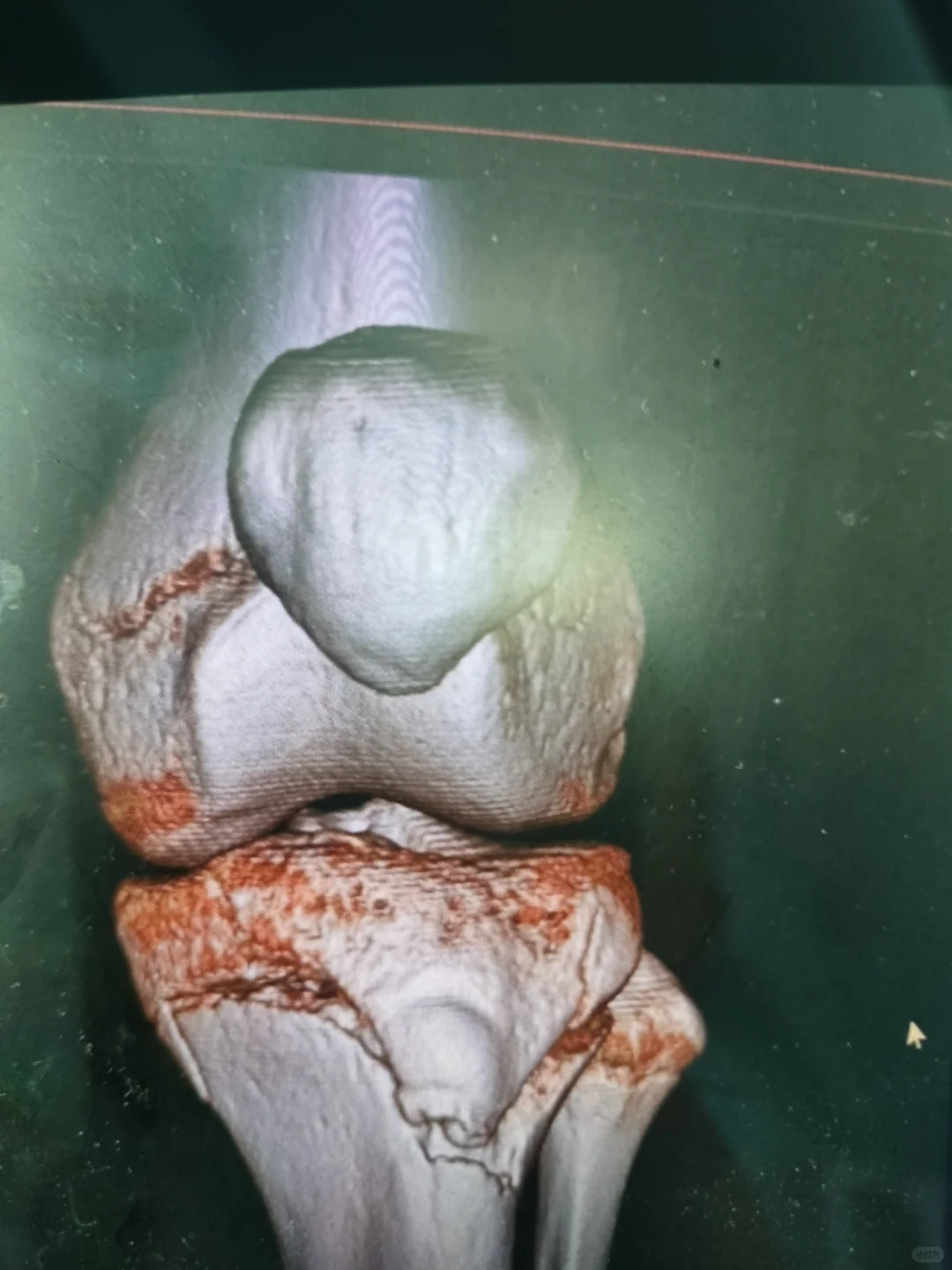 要中考了，怎么办 第4张