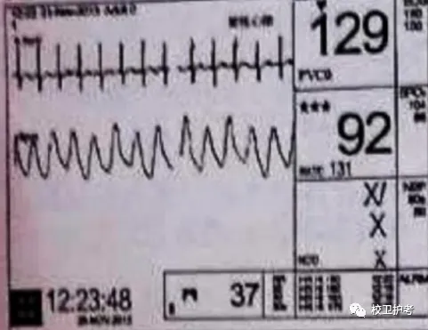 护考历年真题(五) 第2张
