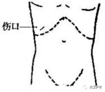护考历年真题(七) 第2张
