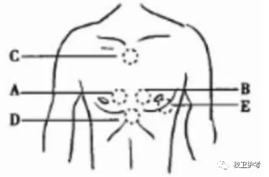 护考历年真题(九) 第3张