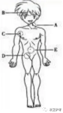 护考历年真题(十) 第2张