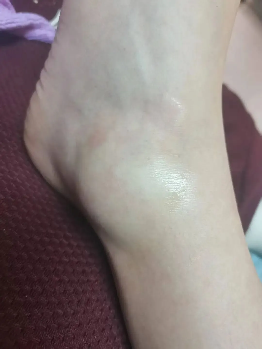 中考倒计时100天,体育考试倒计时30天,中考生脚骨折了,最后体育考试满分,我和孩子是怎么做的?(一) 第9张