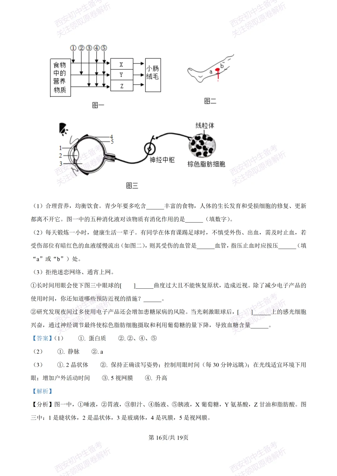 生物复习真题!西安2025中考模拟【高新一中】八年级四模考试,生物试题,试卷+完整版答案,免费下载! 第31张