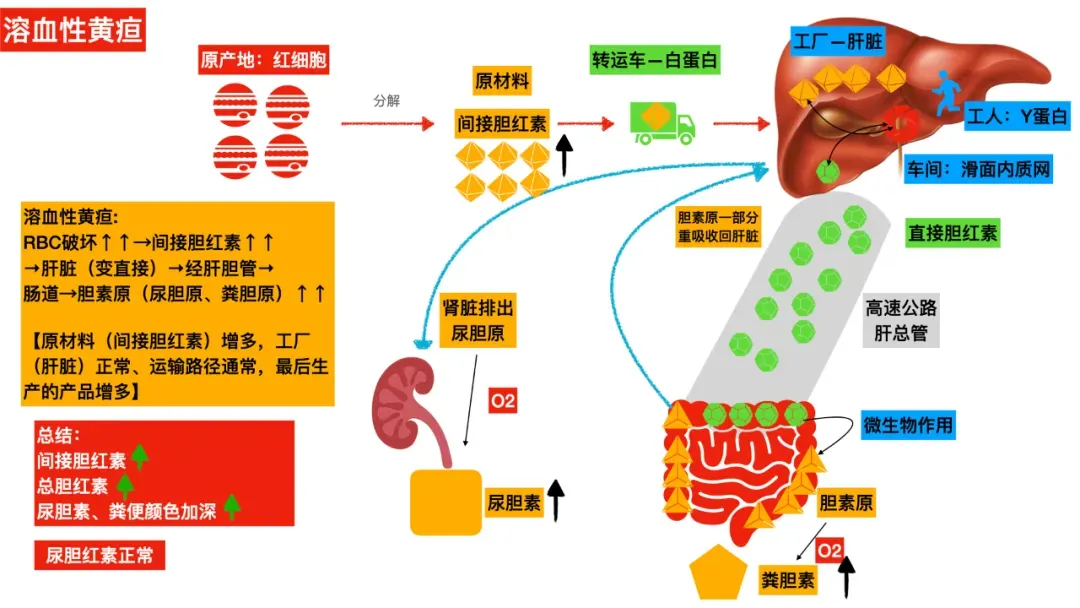 真题考点|每年必考点三种类型的黄疸图解(溶血性黄疸、肝细胞性黄疸、阻塞性黄疸) 第2张