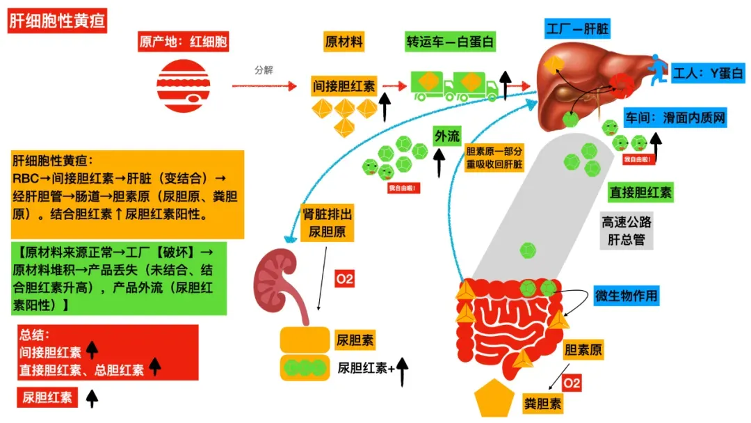 真题考点|每年必考点三种类型的黄疸图解(溶血性黄疸、肝细胞性黄疸、阻塞性黄疸) 第3张