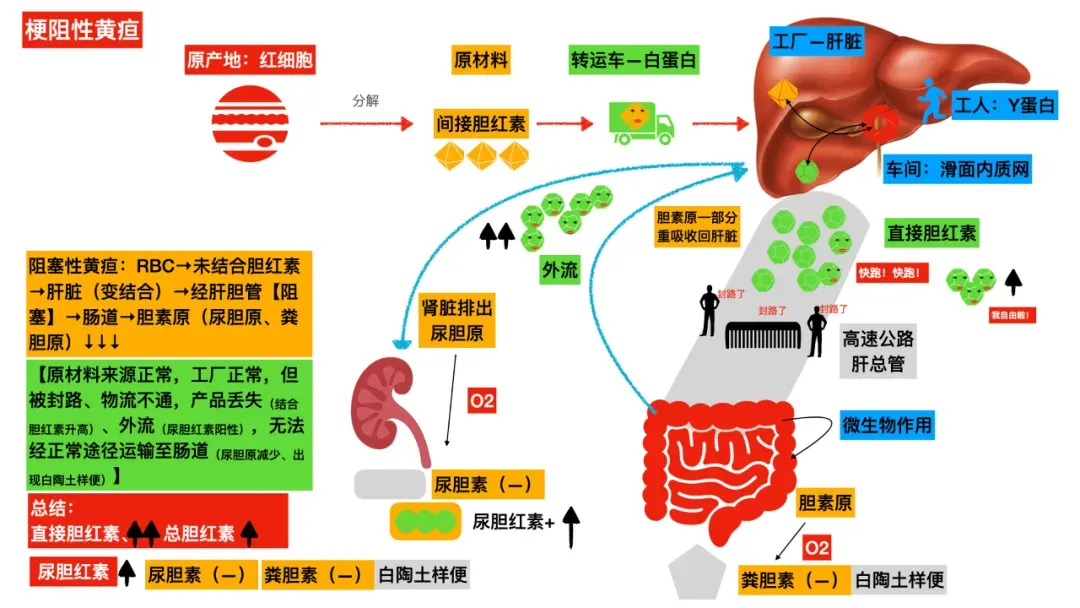 真题考点|每年必考点三种类型的黄疸图解(溶血性黄疸、肝细胞性黄疸、阻塞性黄疸) 第4张