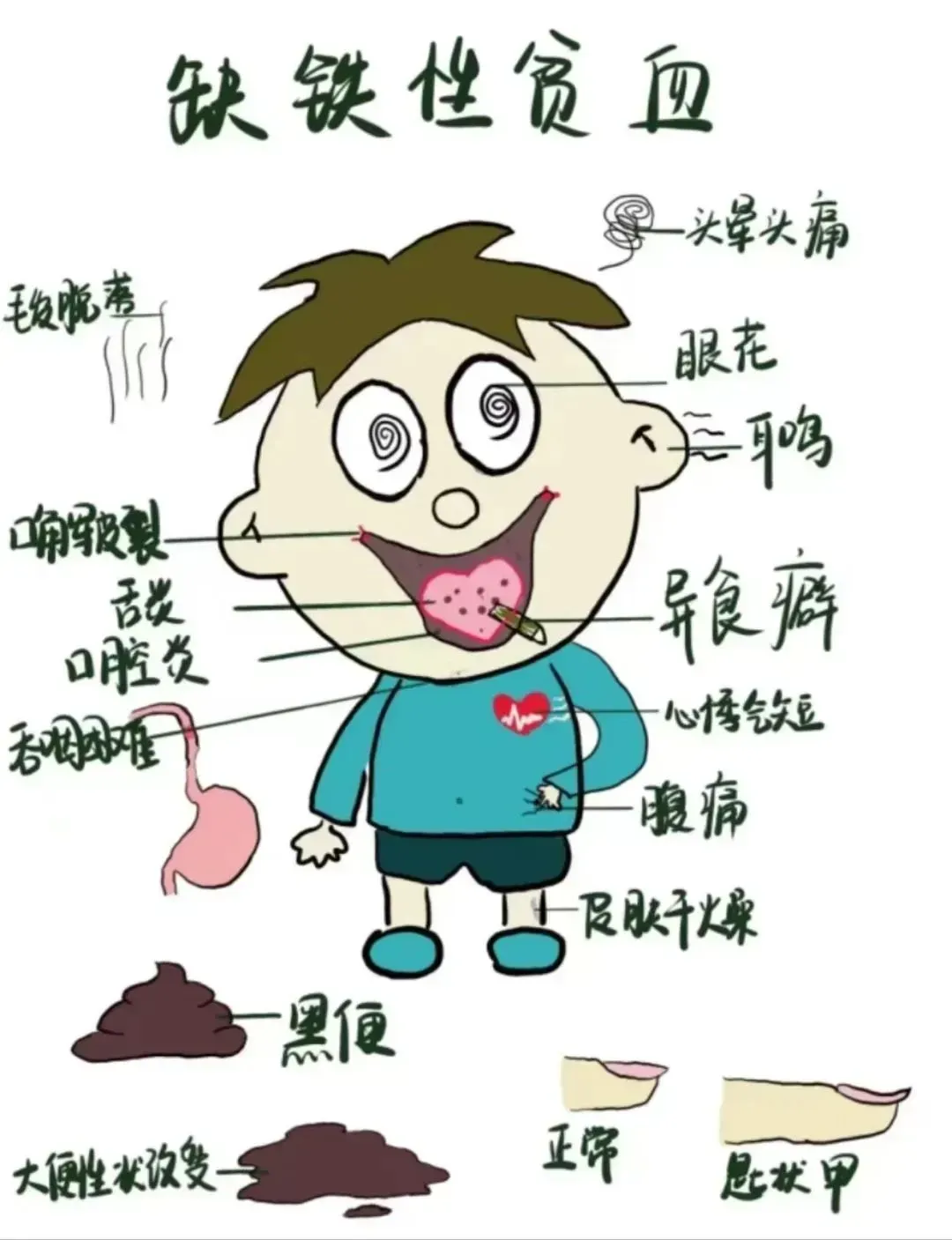 《保育师》儿童疾病预防及管理!理论知识模拟考试题(含答案)学习! 第12张